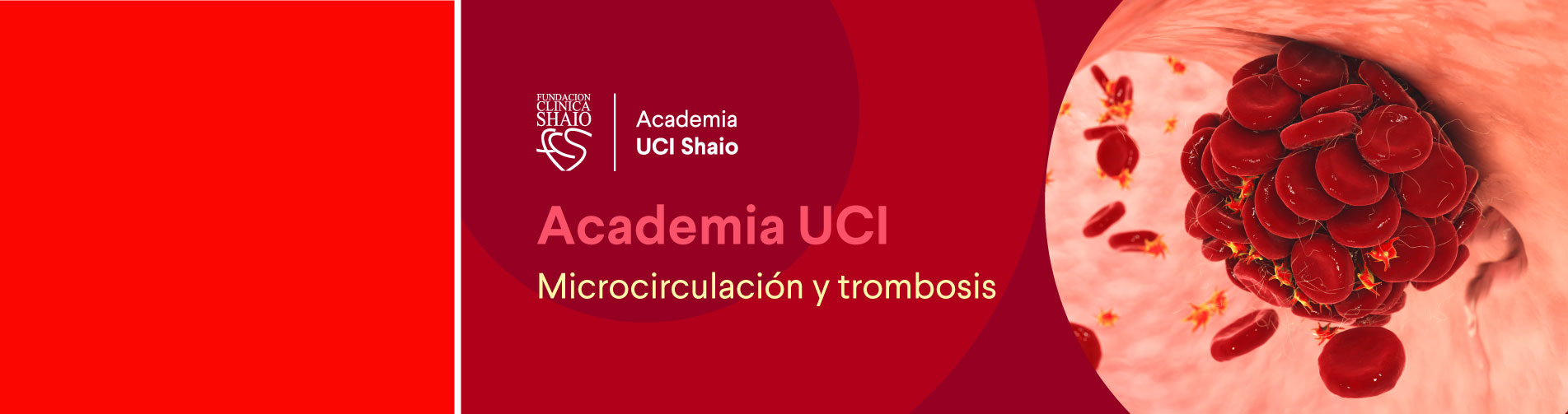 Programa Academia UCI: microcirculación, coagulación y trombosis en el paciente crítico
