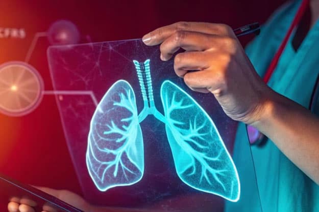 Embolia pulmonar: cuando una señal silenciosa puede poner tu vida en riesgo 