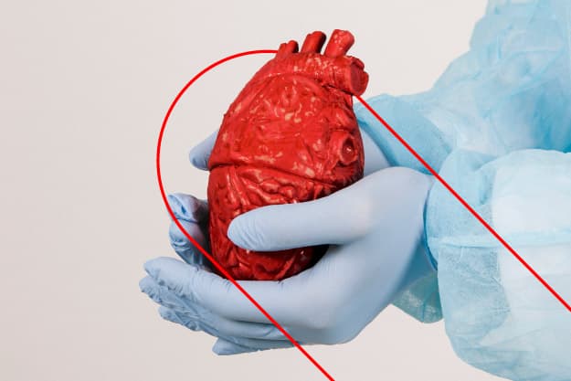 Cirugía cardiovascular mínimamente invasiva