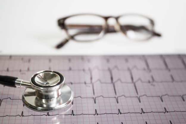 electrocardiograma