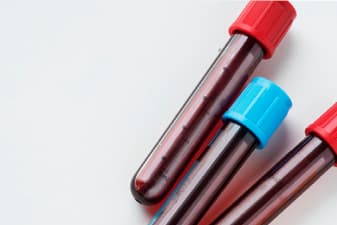 tratamiento-anticoagulante