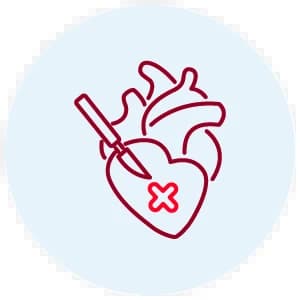 Cirugía Cardiovascular
