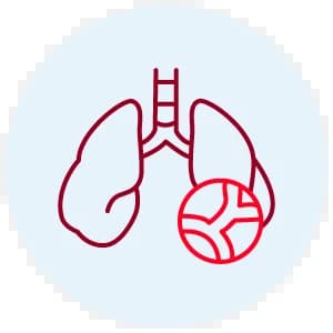 Clínica de Hipertensión Pulmonar