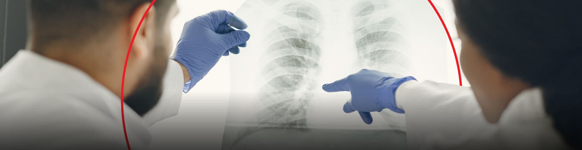 Médicos de hipertensión pulmonar en Colombia