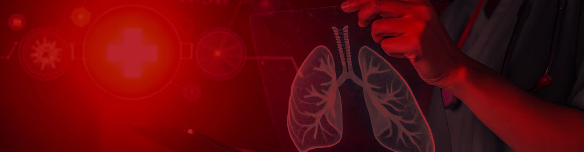 Embolia pulmonar: cuando una señal silenciosa puede poner tu vida en riesgo 