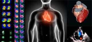 simposio-de-imagenes-diagnosticas-en-cardiologia-2019