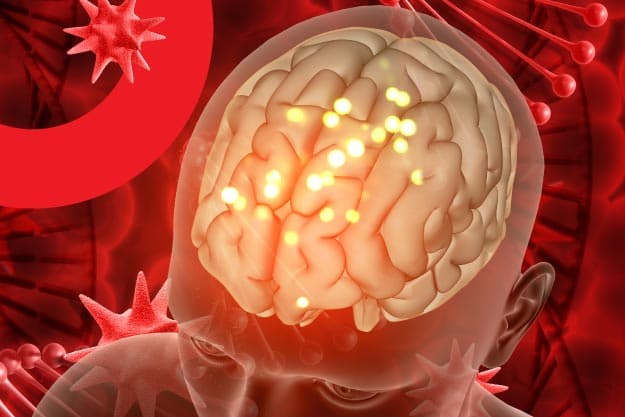 Blog Shaio Meningitis, una inflamación en los tejidos del cerebro y la médula espina Blog Shaio Meningitis, una inflamación en los tejidos del cerebro y la médula espina