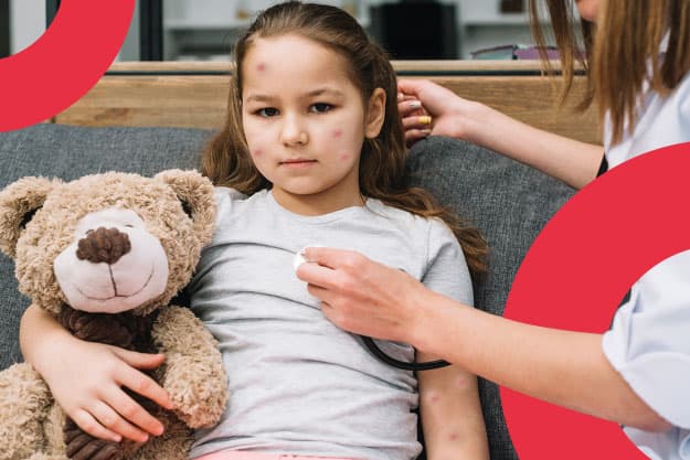 Blog Shaio Sarampión: qué es y por qué se da Blog Shaio Sarampión: qué es y por qué se da